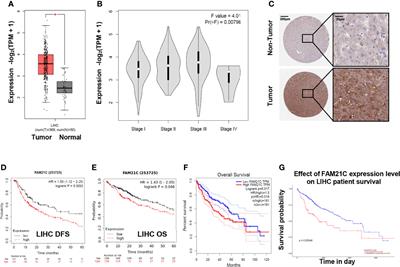 FAM21C Promotes Hepatocellular Carcinoma Invasion and Metastasis by Driving Actin Cytoskeleton Remodeling via Inhibiting Capping Ability of CAPZA1